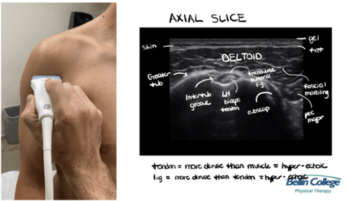 <p>Gel --> skin --> fat --> deltoid w/ fascial marbling --> subscapularis + pec major in the mix --> greater tuberosity + transverse humeral ligament over the intertubercular groove --> LH biceps tendon</p>