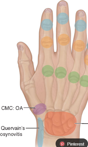 <p>What are the <strong>ORANGE </strong>joints highlighted on the fingers called?</p>