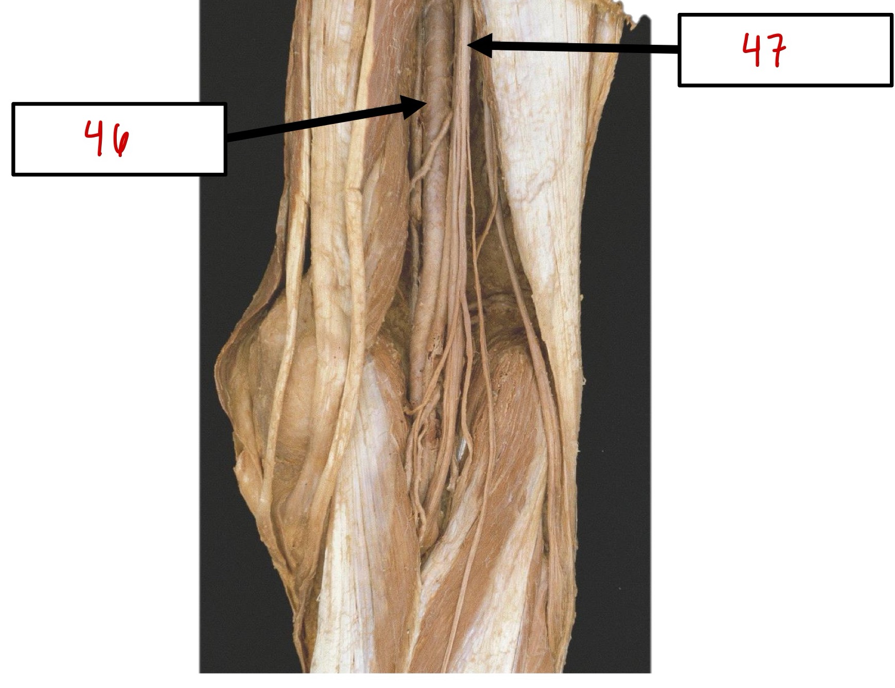 <p>46</p>