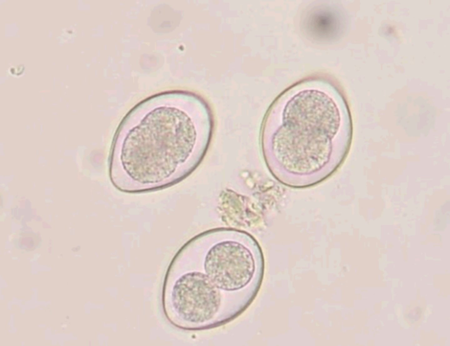 <p>a coccidia species, most common type. 2 major types of isopora are Isospora Canis (dogs) and Isospora Felis (cats). It causes watery diarrhea, several infections can lead to blood in the stool. It is diagnosed by the visualization of oocytes on fecal smear/floatation.</p>
