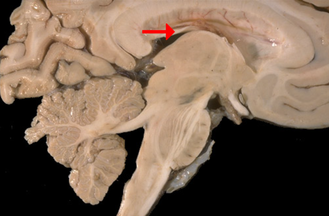 <p>Label this brain part</p>