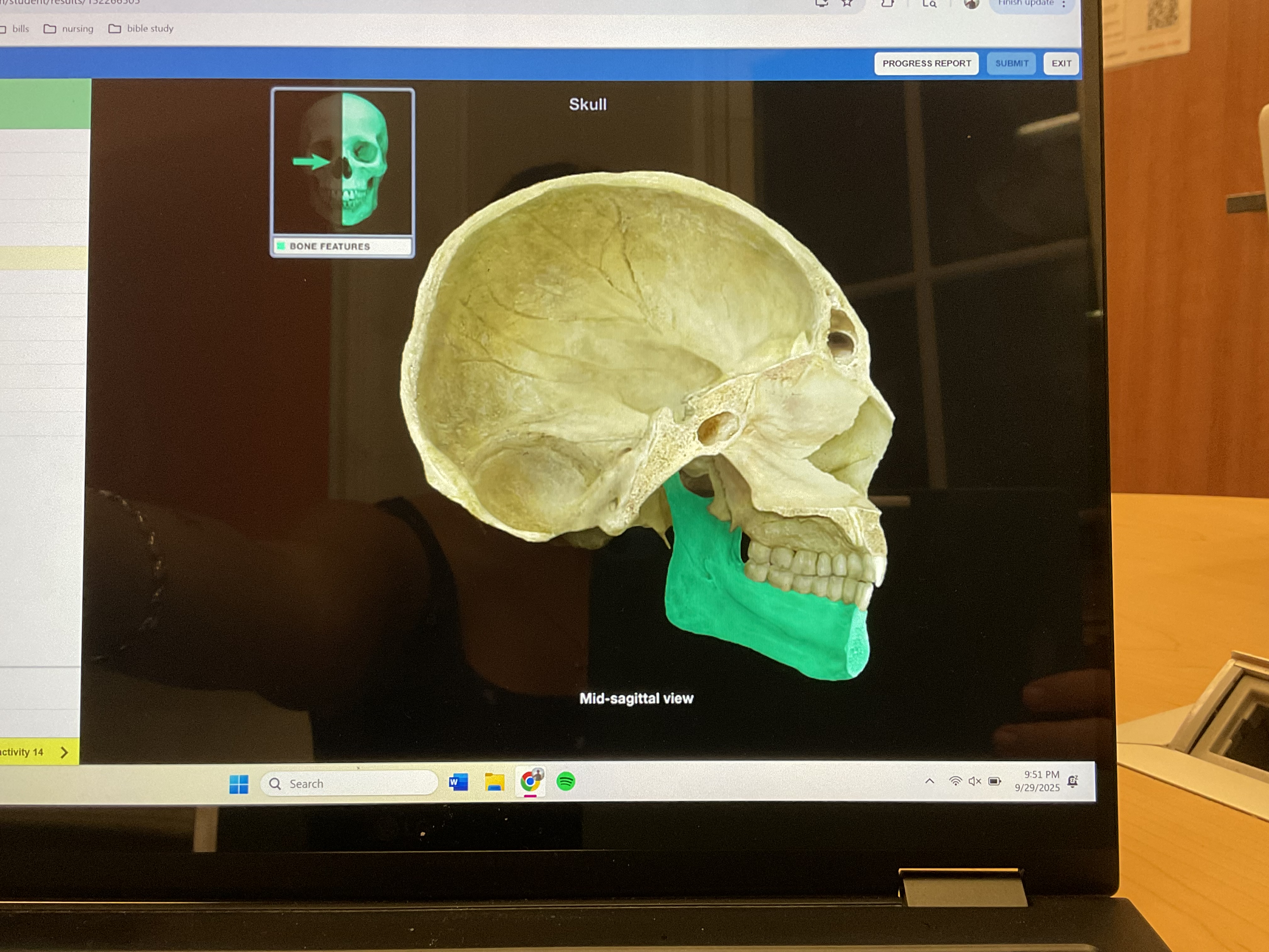 <p>Mandible</p>