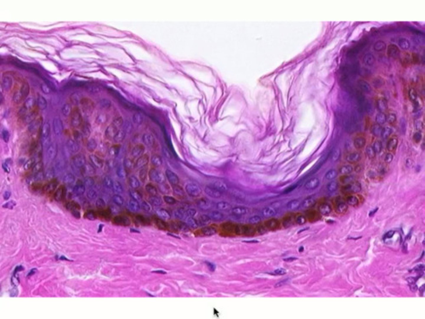 <p>Keratinized stratified squamous epithelium provides a tough, protective layer against mechanical abrasion and pathogen entry.</p>