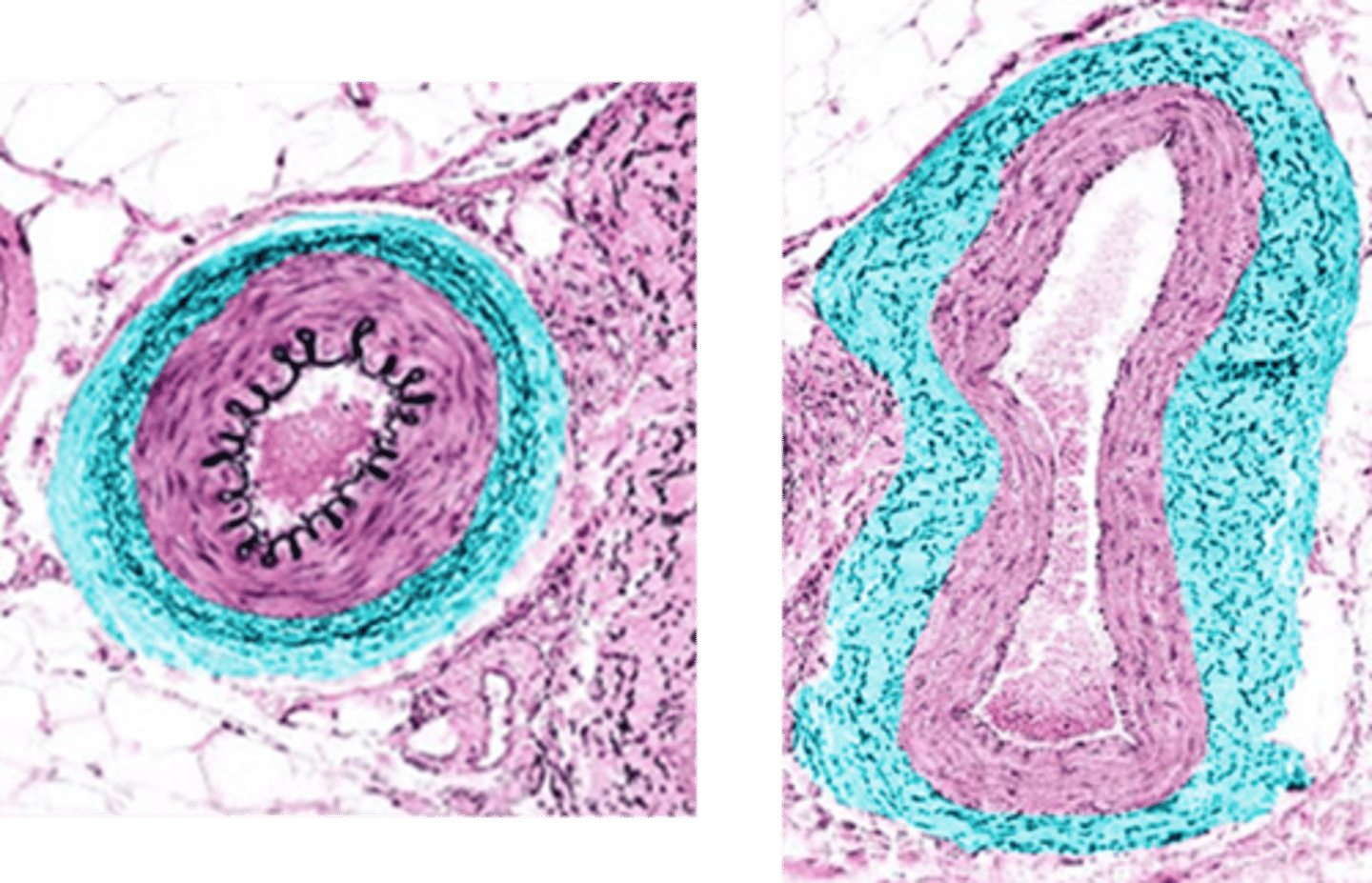 <p>Identify this vessel layer.</p>