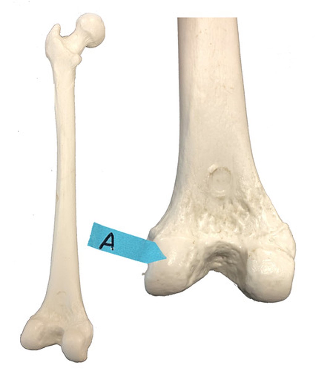 <p>Identify this bone marking.</p>