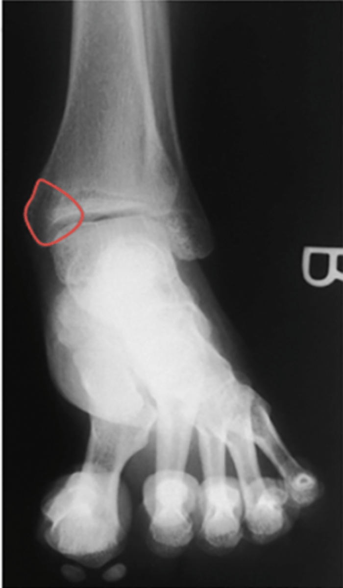 <p>What structure is highlighted?</p>