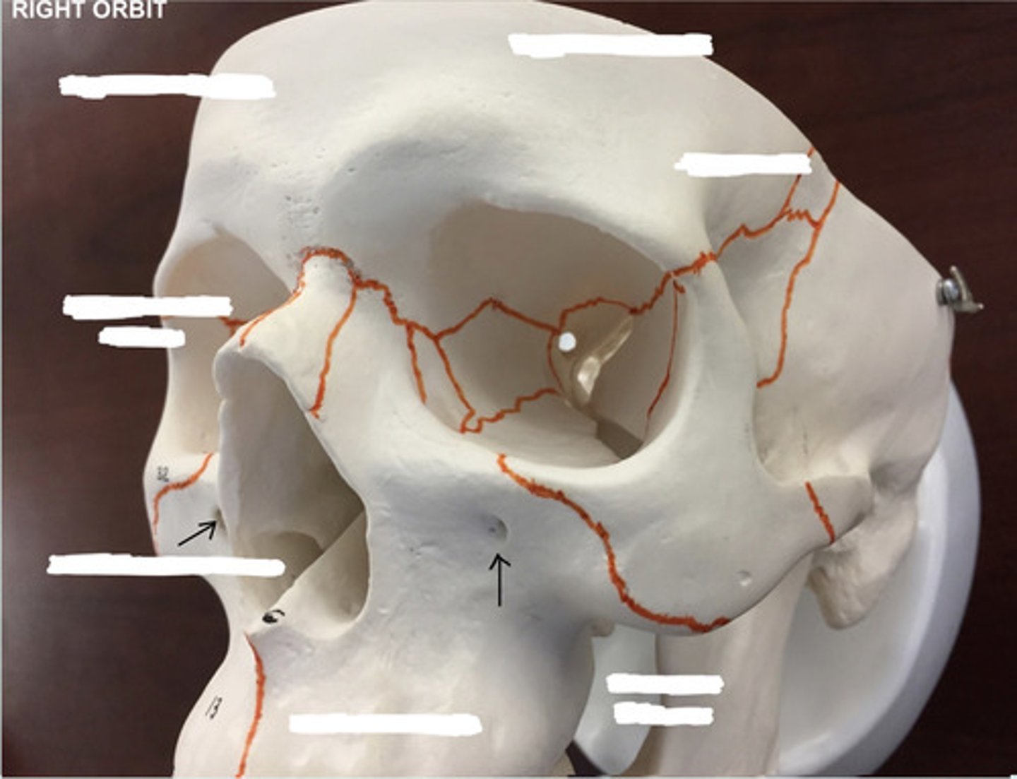 <p>What structure is pointed to here?</p>