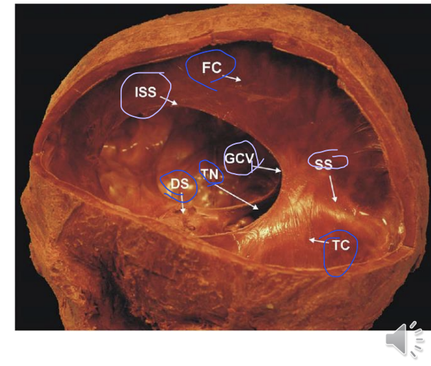 <p>What are these sections?</p>