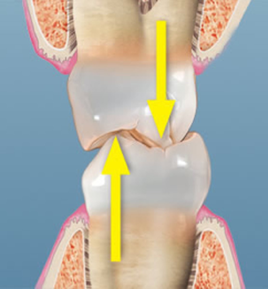 <p>They ensure proper occlusion and distribute biting forces evenly.</p>