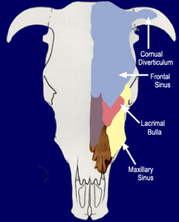 <p><span>Is a large sinus of major </span><strong><span>clinical</span></strong><span> importance</span></p><ul><li><p><span>Extends medially to form the </span><strong><span>palatine sinus</span></strong><span> and caudally to form the</span><strong><span> lacrimal bulla</span></strong><span>, which protrudes into the orbit</span></p></li><li><p><span>Communicates with the nasal cavity via the </span><strong><span>nasomaxillary opening*</span></strong><span>, positioned dorsal to the main sinus compartment</span></p></li><li><p><strong><span>Clinical significance:</span></strong><span> sinus infections are difficult to drain because the drainage opening* is high (dorsal) relative to the sinus floor (1)</span></p><ul><li><p><span>Roots of the upper cheek teeth project into the ventral floor (Sinus enlarges with age, increasing dental association)… so the cheek teeth are WITHIN the maxillary sinus (2)</span></p><ul><li><p>Dental disease is the the MOST FREQUENT cause of secondary sinusitis</p></li></ul></li></ul></li></ul><p></p><p>So basically, maxillary sinus can become infected by dental disease, and the infection won’t be able to drain due to the position of the nasomaxillary opening </p><p></p>
