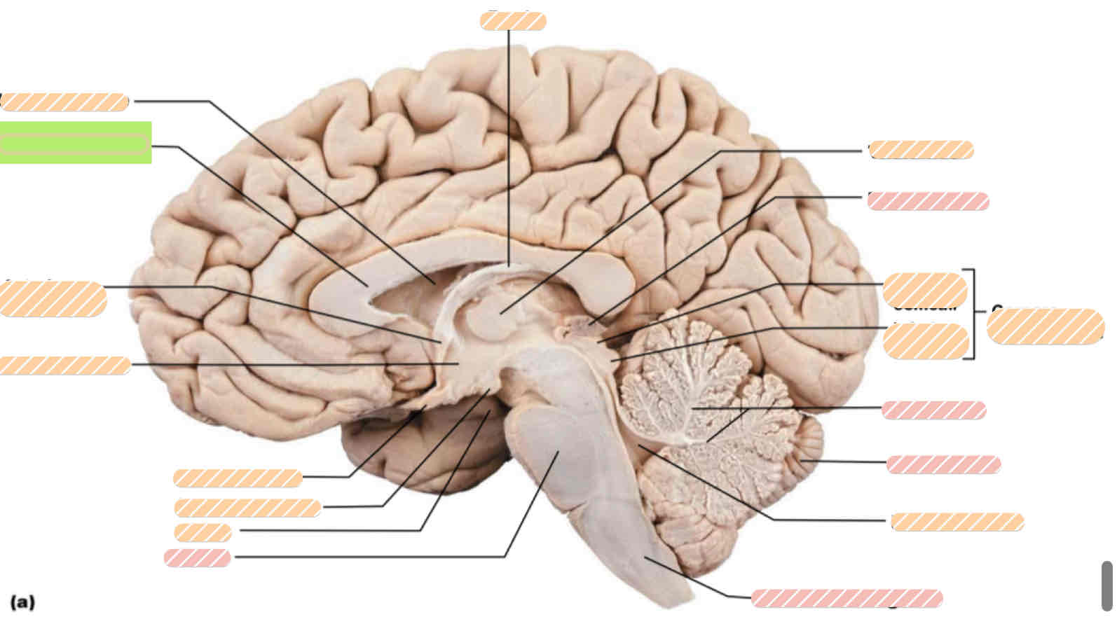 <p>Human brain</p>