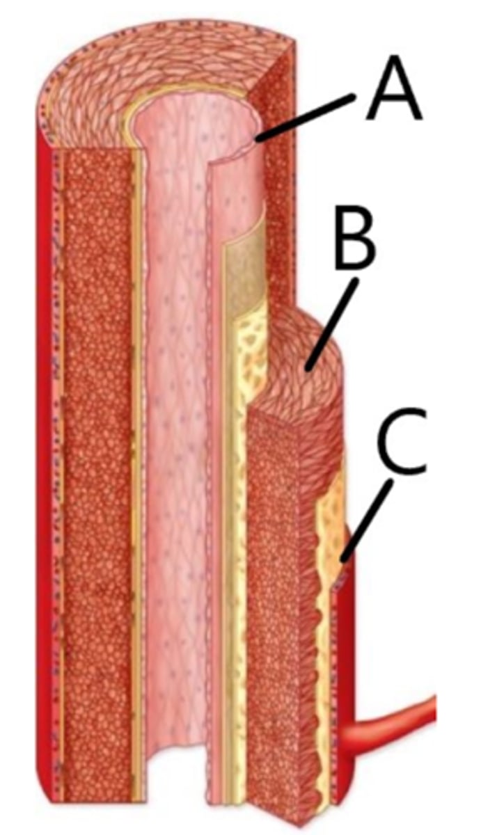 <p>A- tunica intima B- tunica media C- tunica externa</p>