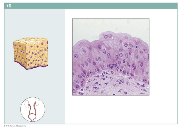 <p>Epithelial layers that are multiple layers thick</p><ul><li><p>e.g bladder, tongue</p></li></ul><p></p>