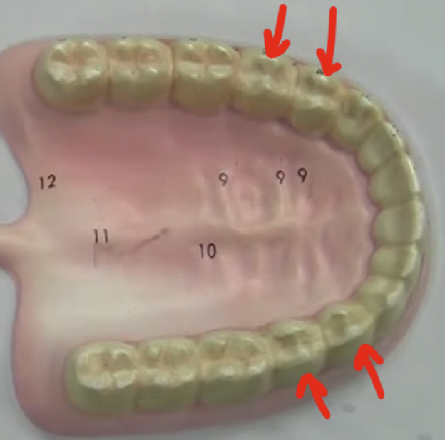 <p>2 in a quadrant, 8 in the whole mouth&nbsp;</p>