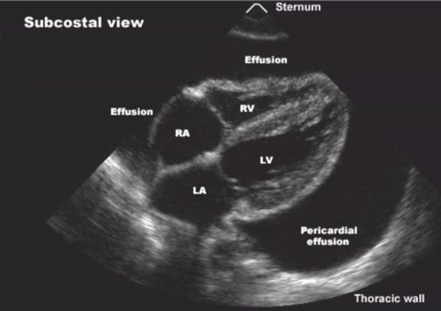 <p>echocardiogram, echo</p>