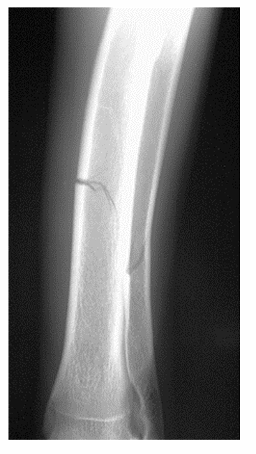 <p>what type of condition is this?</p>