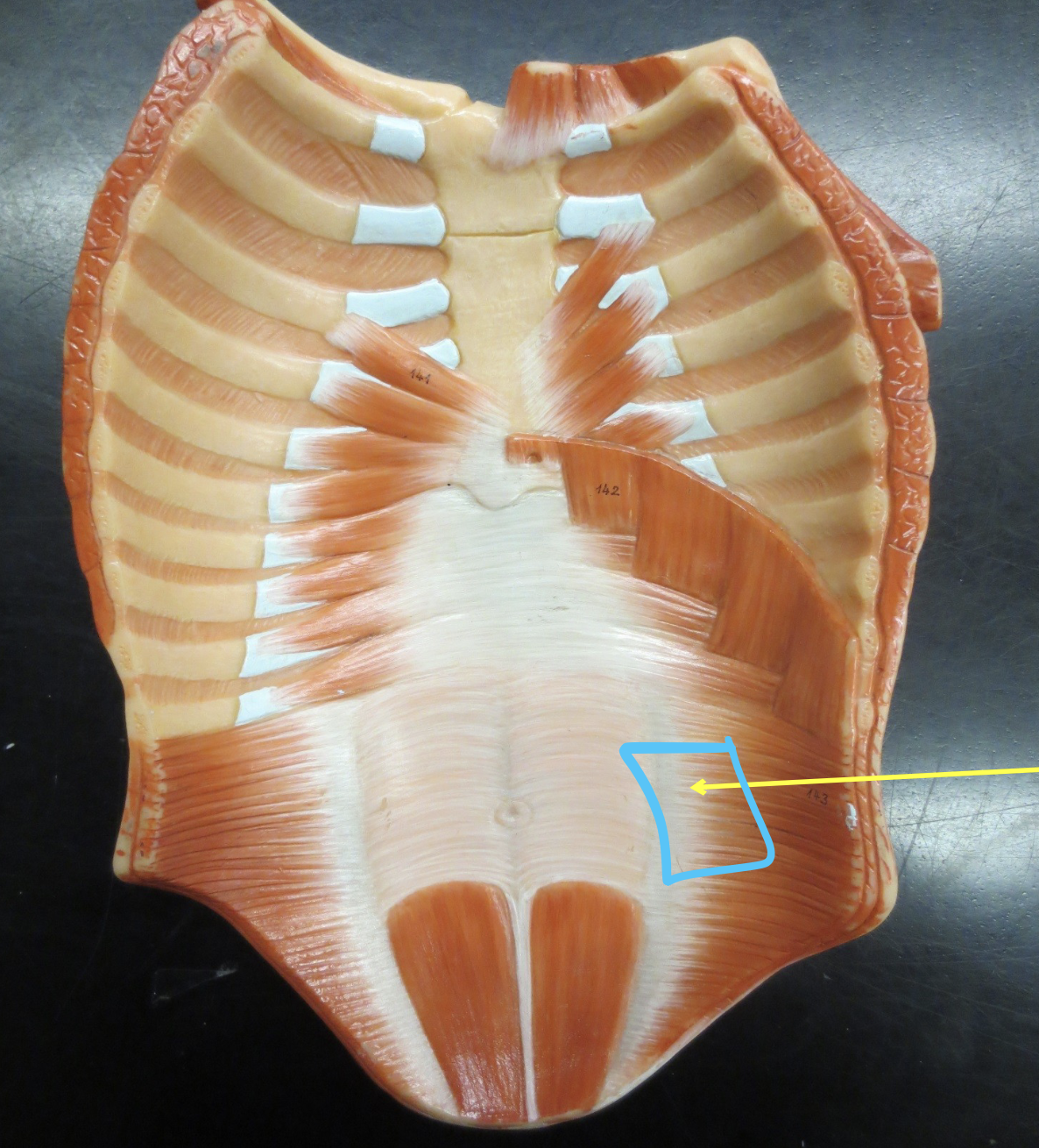 <p>Which muscle</p>