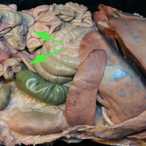 <p><span>Areas of diffuse lymphatic tissue are found in the walls of the structures marked by the green arrows. They are called the///<strong>small intestine</strong></span></p>