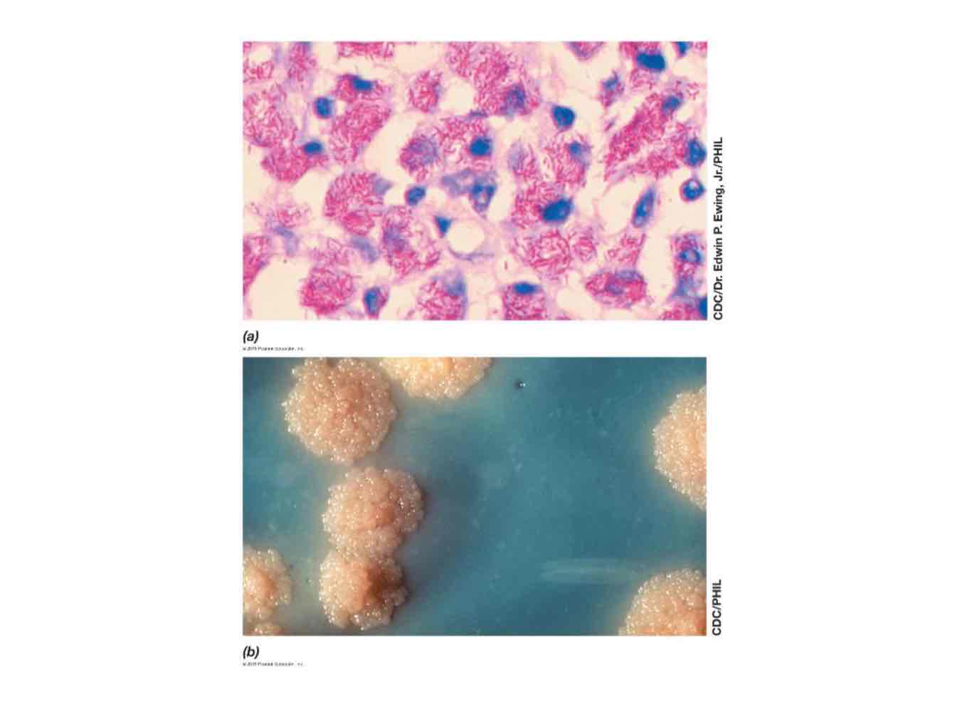 <p>Mycobacteria has a layer of mycolic acids outside the peptidoglycan layer, making them acid-fast.</p>