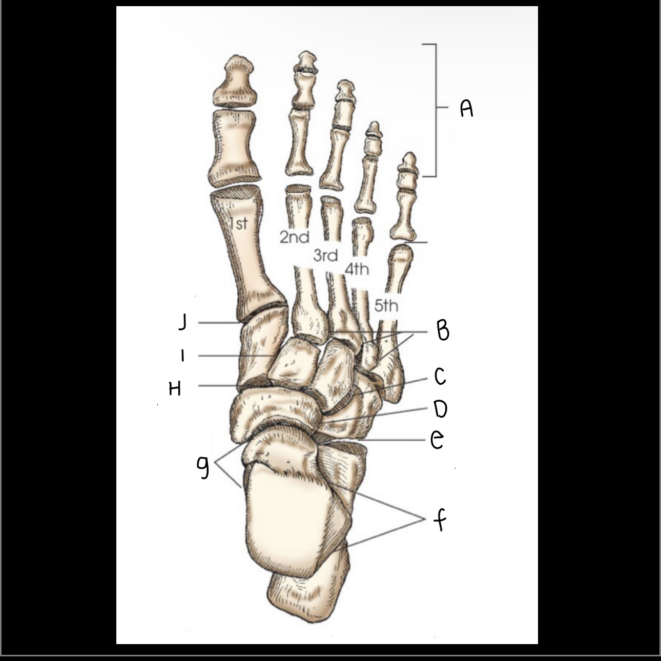 <p>What is letter B pointing to?</p>