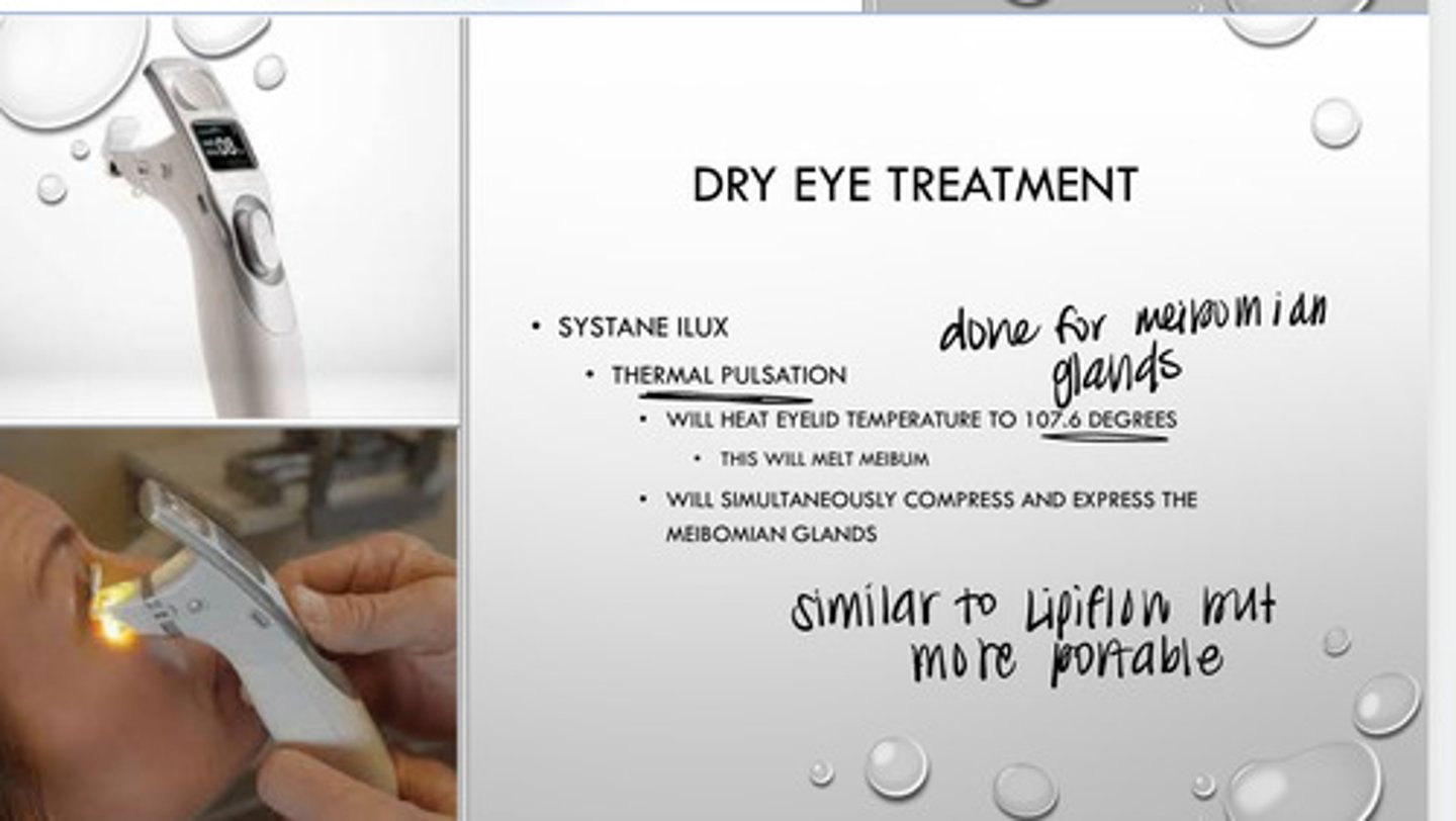 <p>What is the Systane Ilux?</p>
