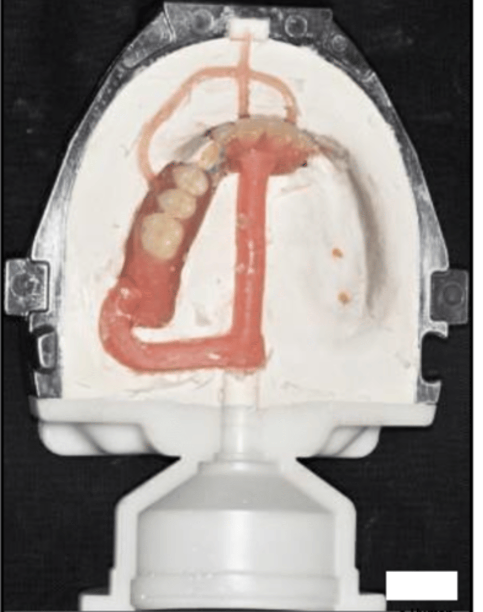 <p>What procedure is this image from?</p>