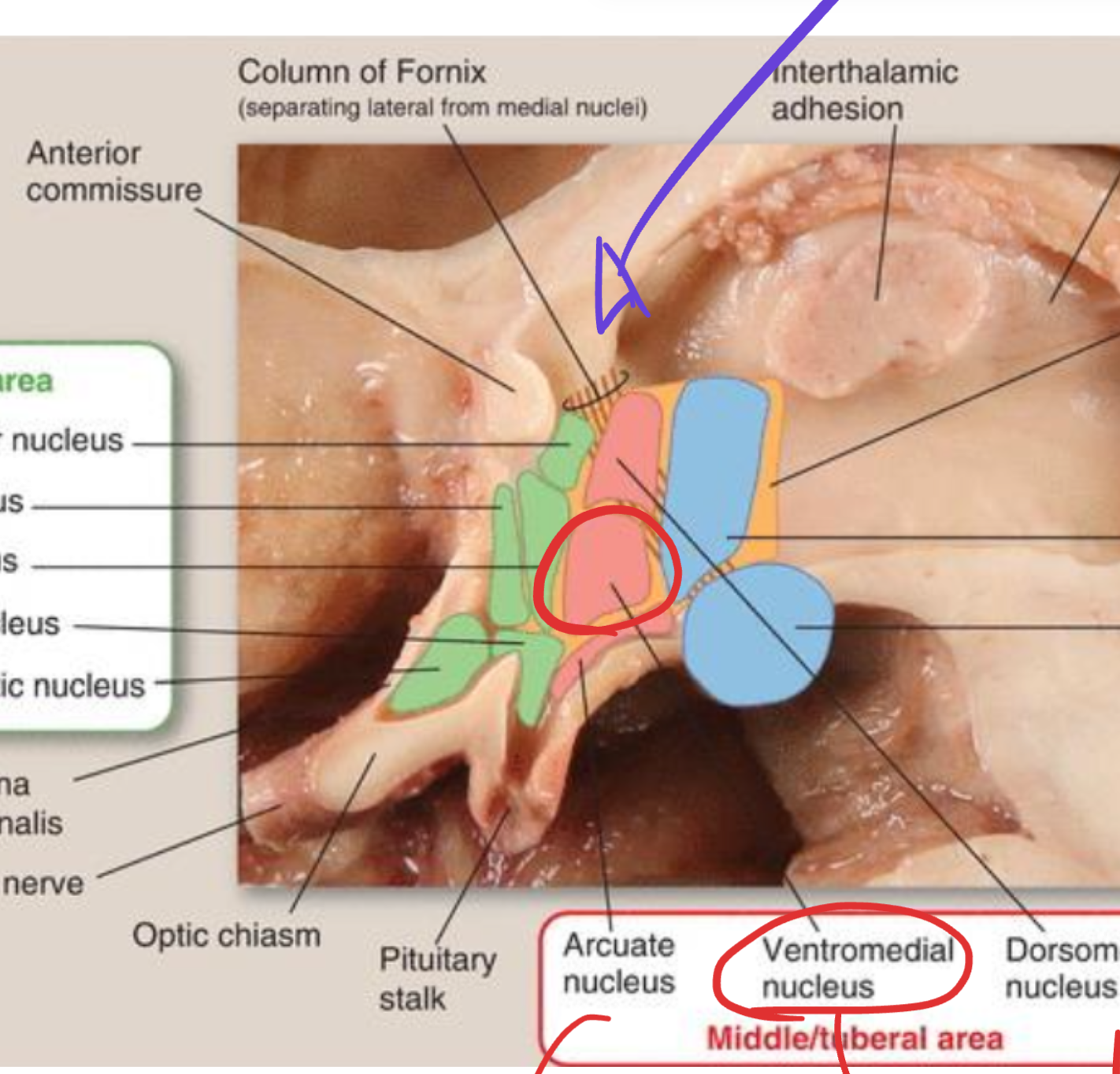 <p>Ventromedial nucleus</p>