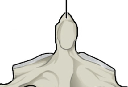 <p>What holds the atlas C1 and aid with neck movement?</p>