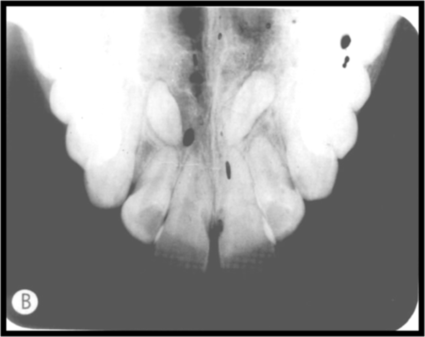<p>-Contamination by developer</p><p>-Developer splash</p><p>-Dark spots caused by premature contact of film surface with developer</p>