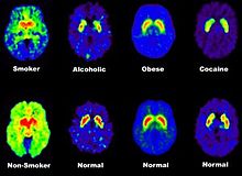 <p>Looks @ metabolic process for disorders &amp; cancer</p>