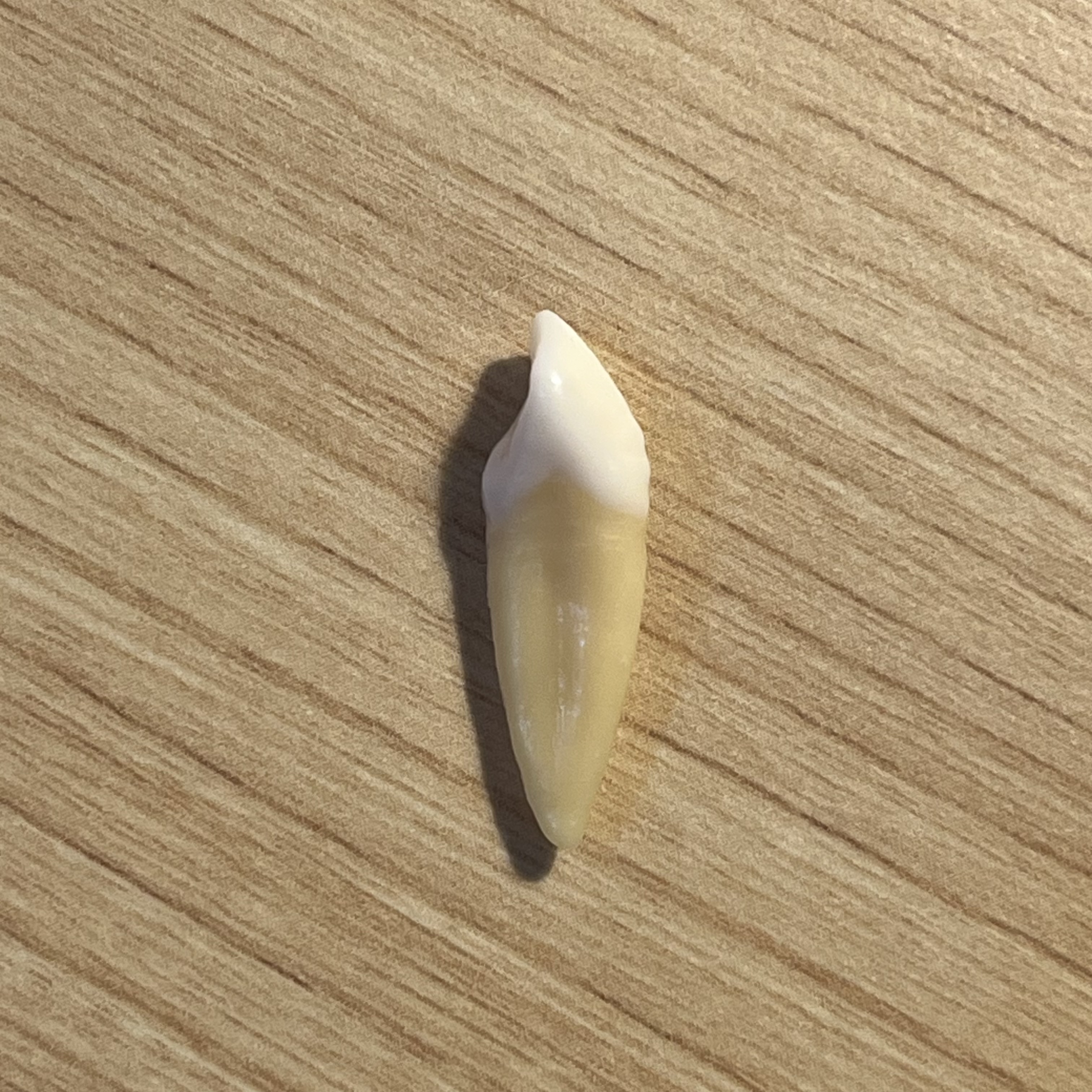 <p>What tooth is this (with view)?</p>