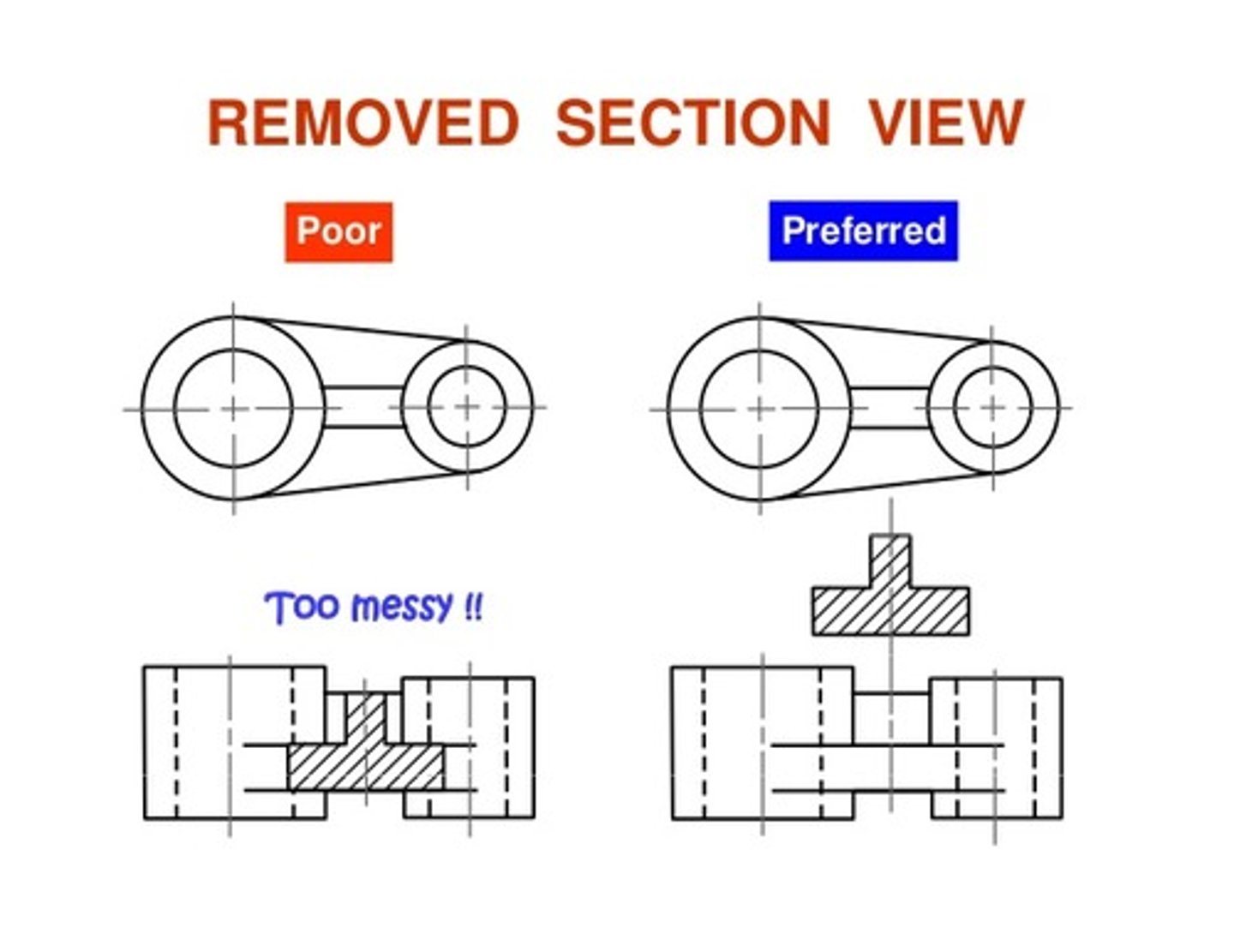 <p>A section view that is not in direct projection alignment but is placed elsewhere on the drawing sheet.</p><p>Basically: When a section cut out is done, but looks way too messy, the "Removed section" feature allows u to take the cross-section (ONLY the cross section and not an entire drawing) out elsewhere in the drawing paper for deeper examination.</p>