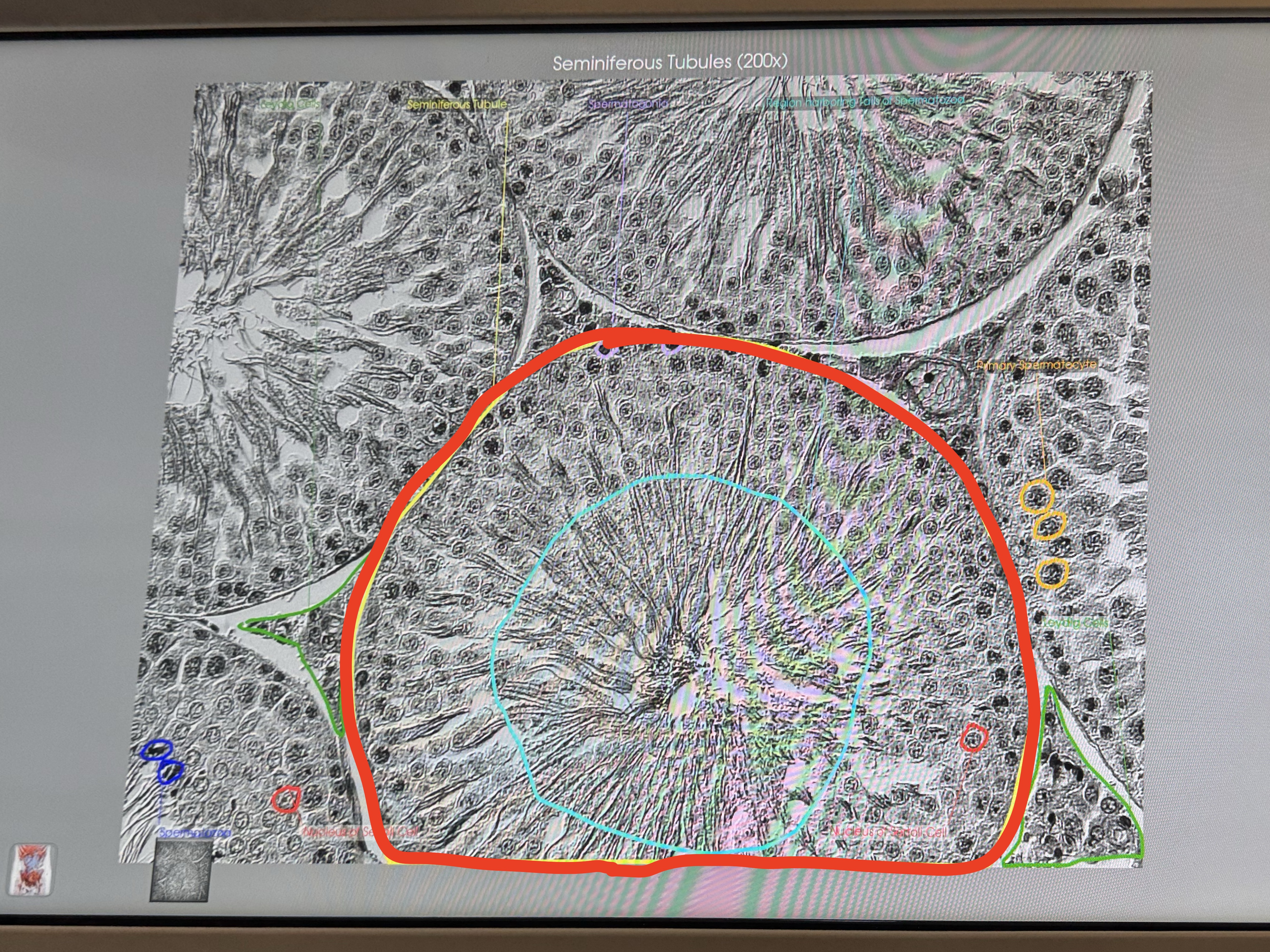 <p>Testis: identity these structures</p>