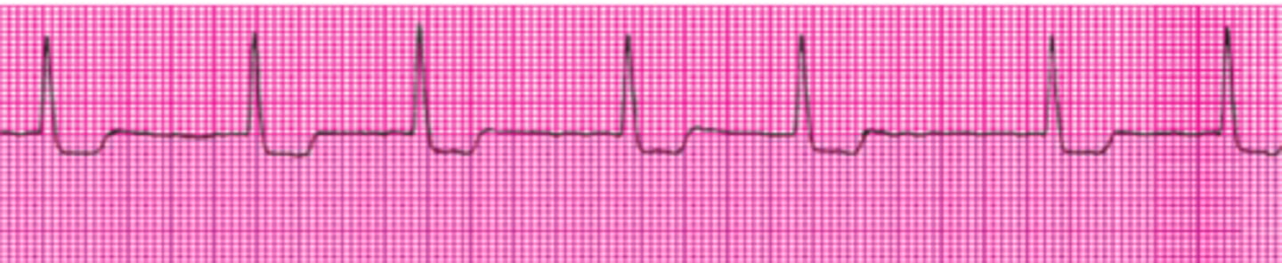 <p>Name this rhythm.</p>