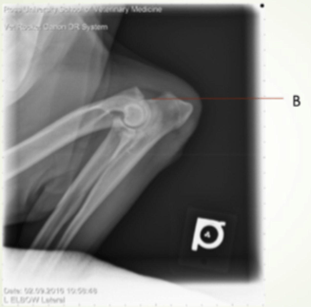 <p>beak shaped at proximal end of trochlear notch, resides into olecranon fossa</p>