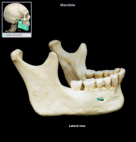 holes on mandible