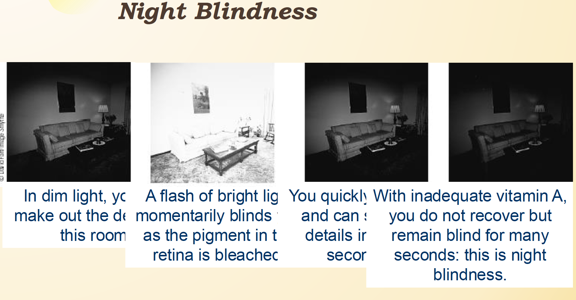 <ul><li><p>in a dark room, you can make out shapes. Then a flash of bright light blinds you, as the pigment in the retina is bleached! Your eyes adjust! Without Vit A, this process takes much longer </p></li><li><p>After this- the production of mucus in our tears will DEC, drying the cornea of our eyes! This can cause blindness </p></li><li><p>The leading cause of blindness in kids world wide! </p></li></ul><p></p>