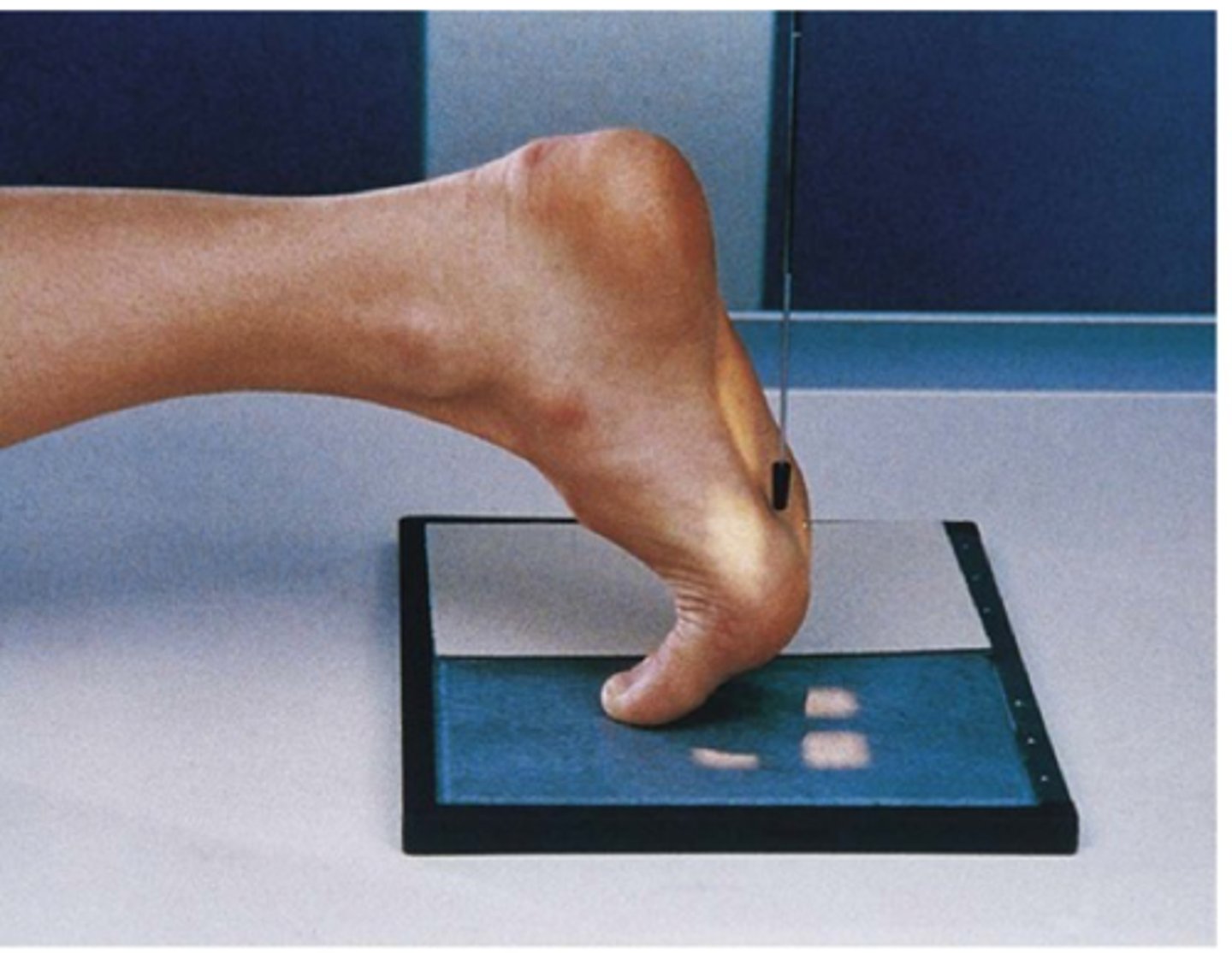 <p>perpendicular to first MTP joint</p>