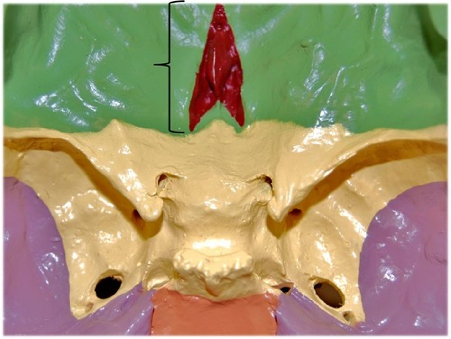<p>Name this bone of the skull (superior view).</p>