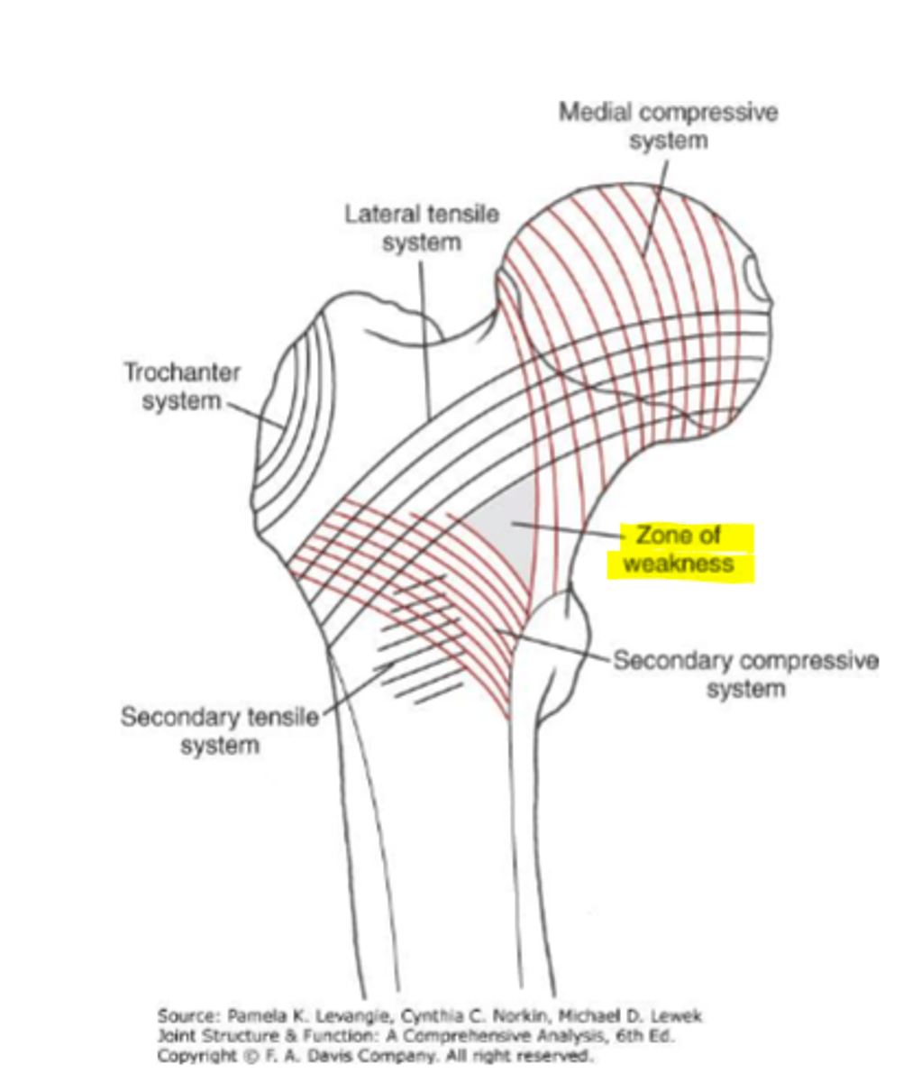 <p>area in the femoral neck have fewer trabecular fibers</p>