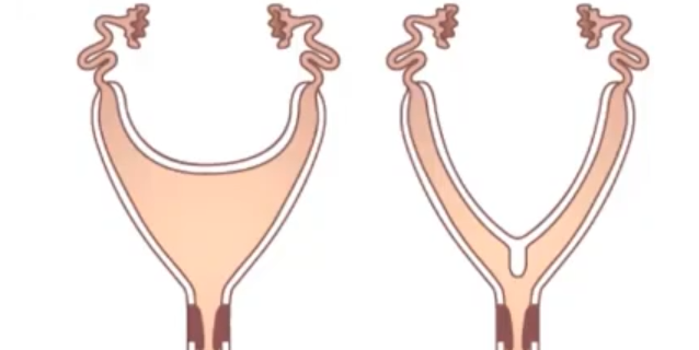 <p>Uterus Type + Species</p>