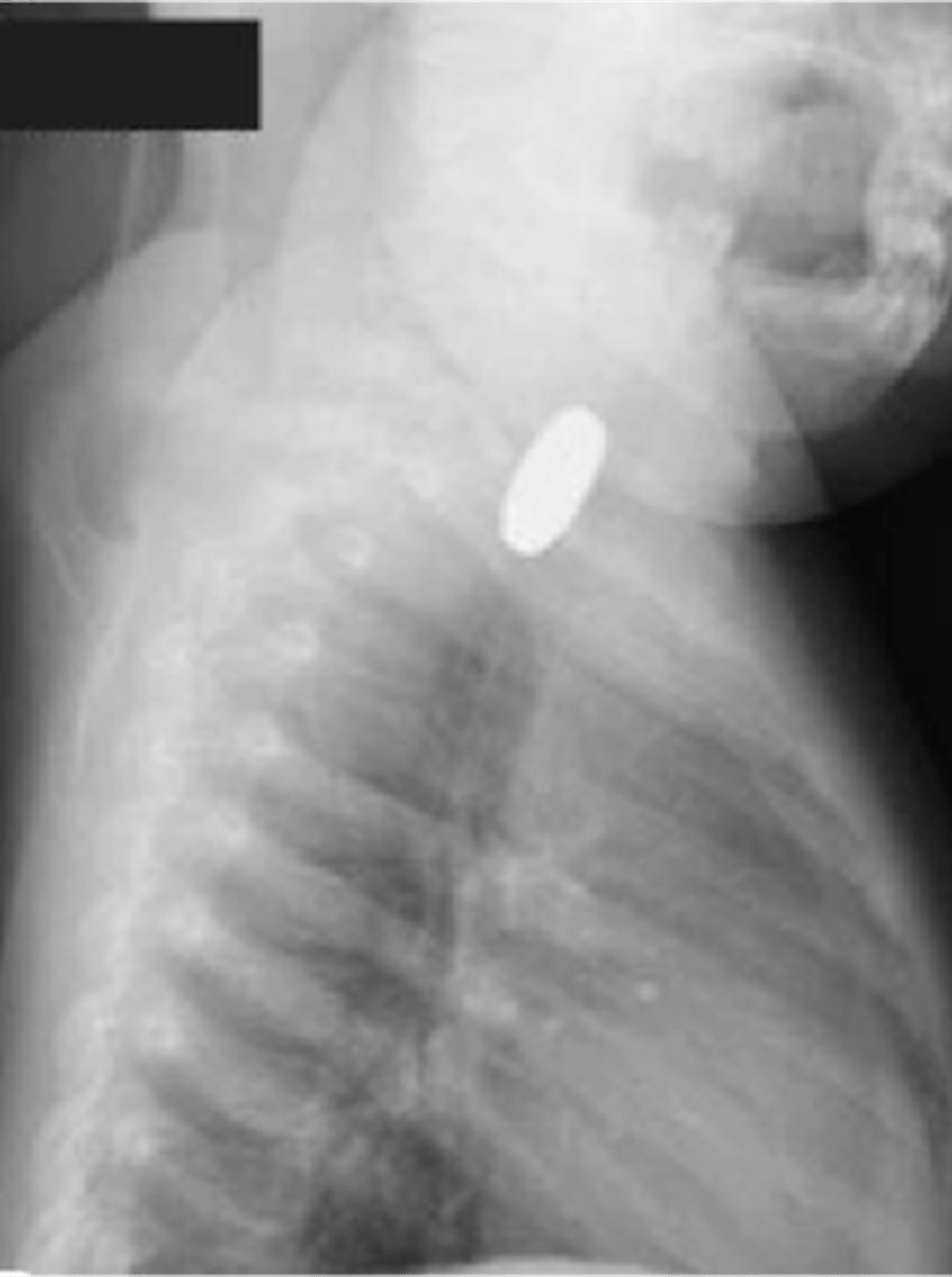 <p>How should you radiograph foreign bodies?</p>