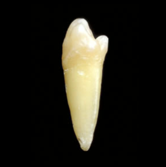 <p>Tooth #, Eruption, and Root Formation</p>