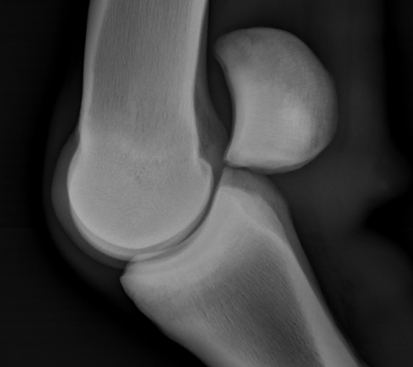 <p>ID joint and view</p>