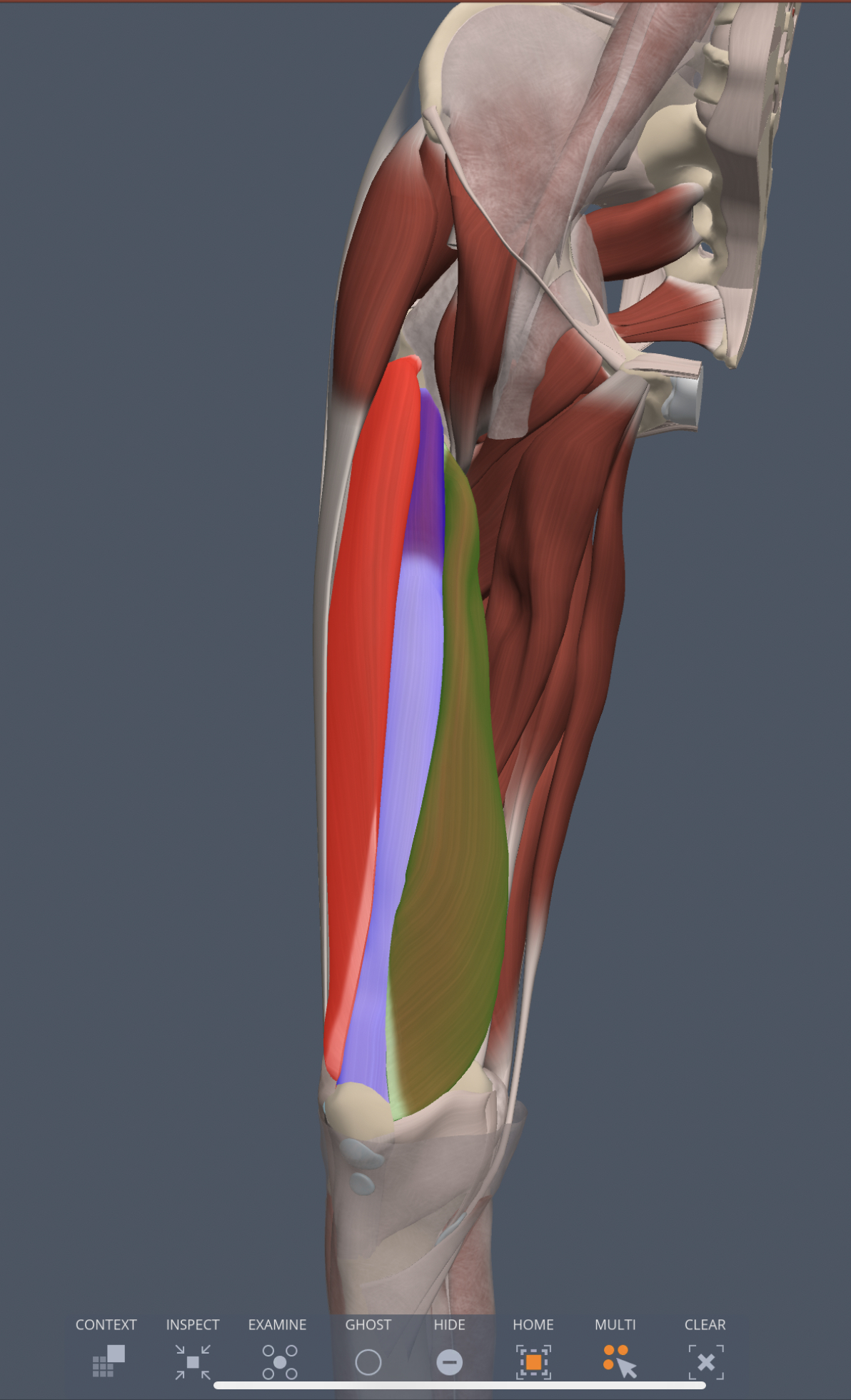 vastus intermedius (anterior thigh) insertion
