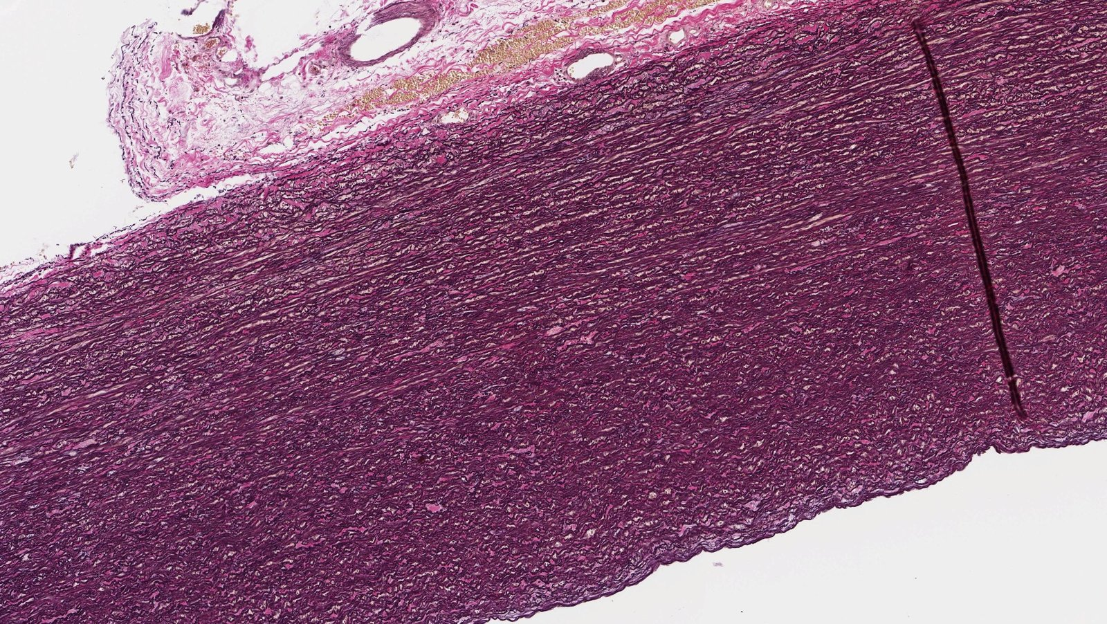 <p>B. Common carotid artery (A. carotis communis)</p>