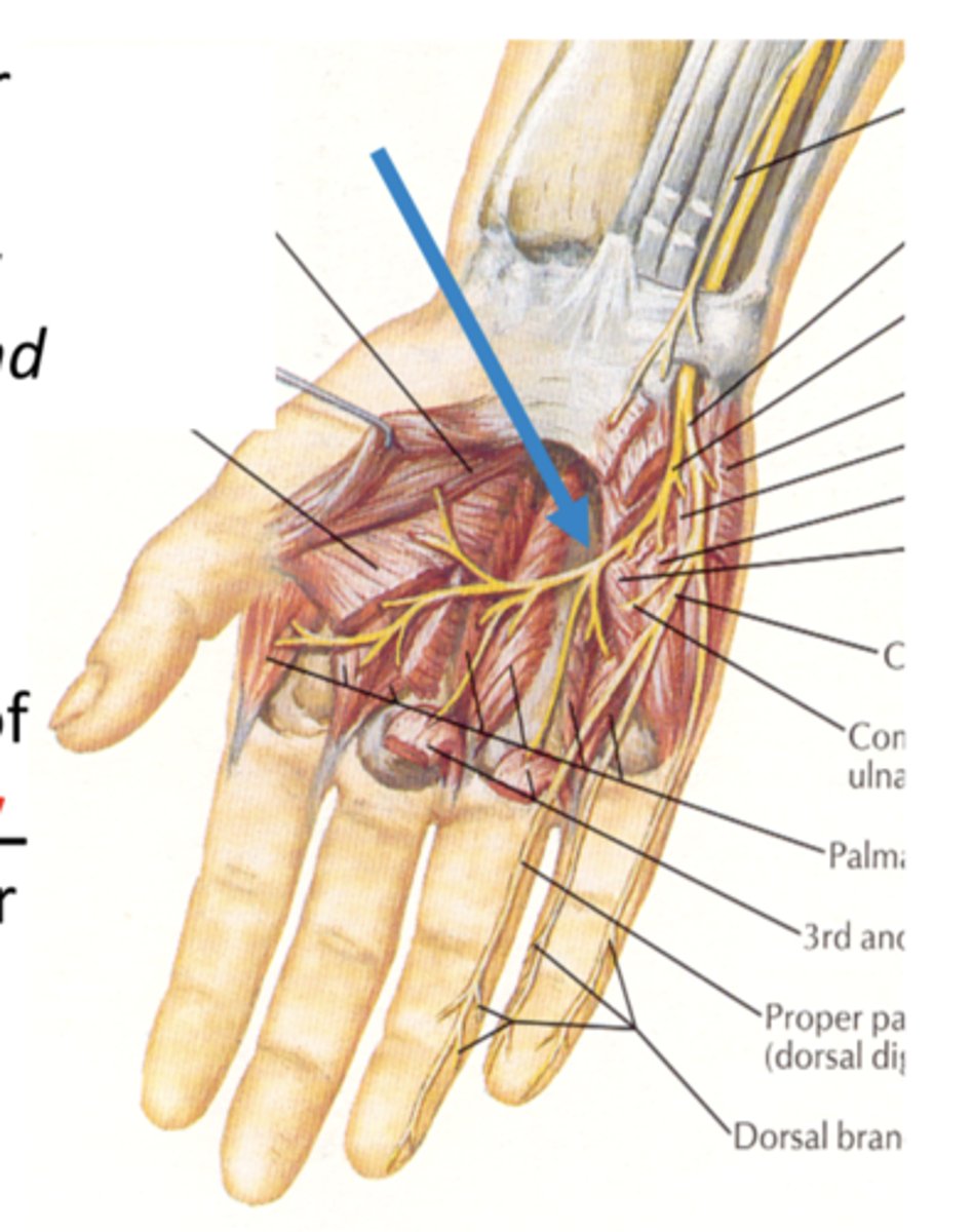 <p>hook of the hamate</p><p>laterally across the palm</p><p>anterior to the interossei muscles </p>