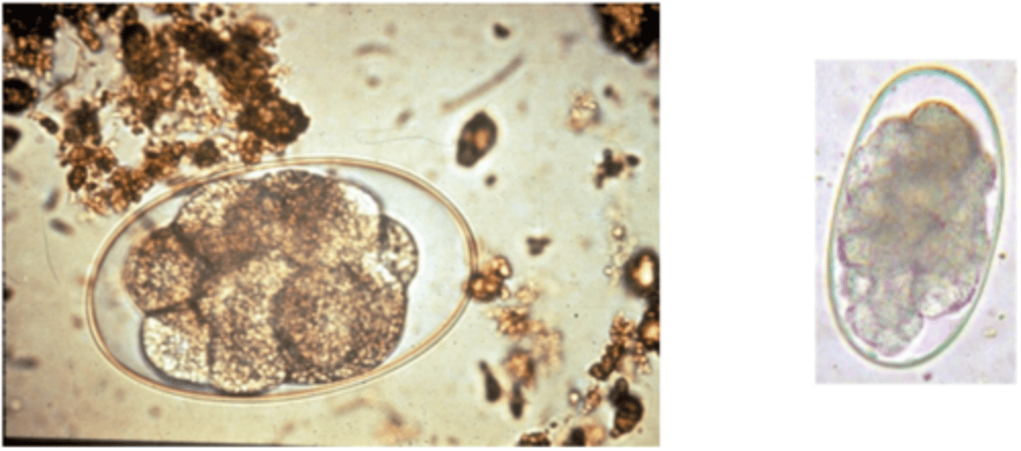 <p>Strongyle-type egg</p>