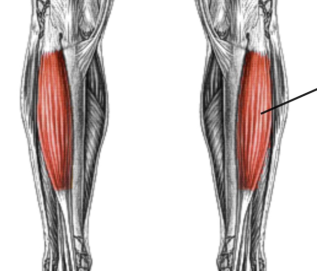 <p>Which muscle of the foot/ankle is:</p><ul><li><p>On anterior tibia</p></li><li><p>Action: dorsiflex ankle, inversion</p></li><li><p>Nerve: <span style="color: yellow;">deep fibular</span></p></li></ul><p></p>