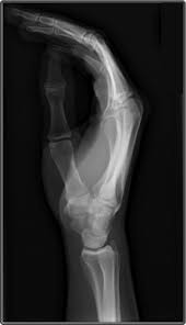 <p>what carpal is attached to the wrist in this pic</p>
